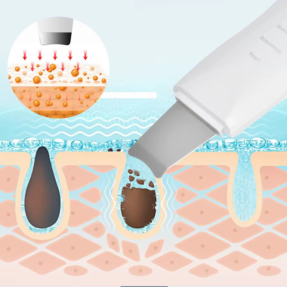Ultrasonic Face Scrubber - Zelo™