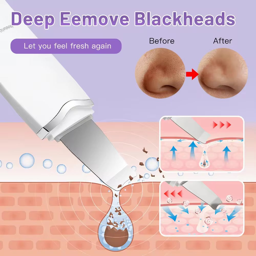 Ultrasonic Face Scrubber - Zelo™